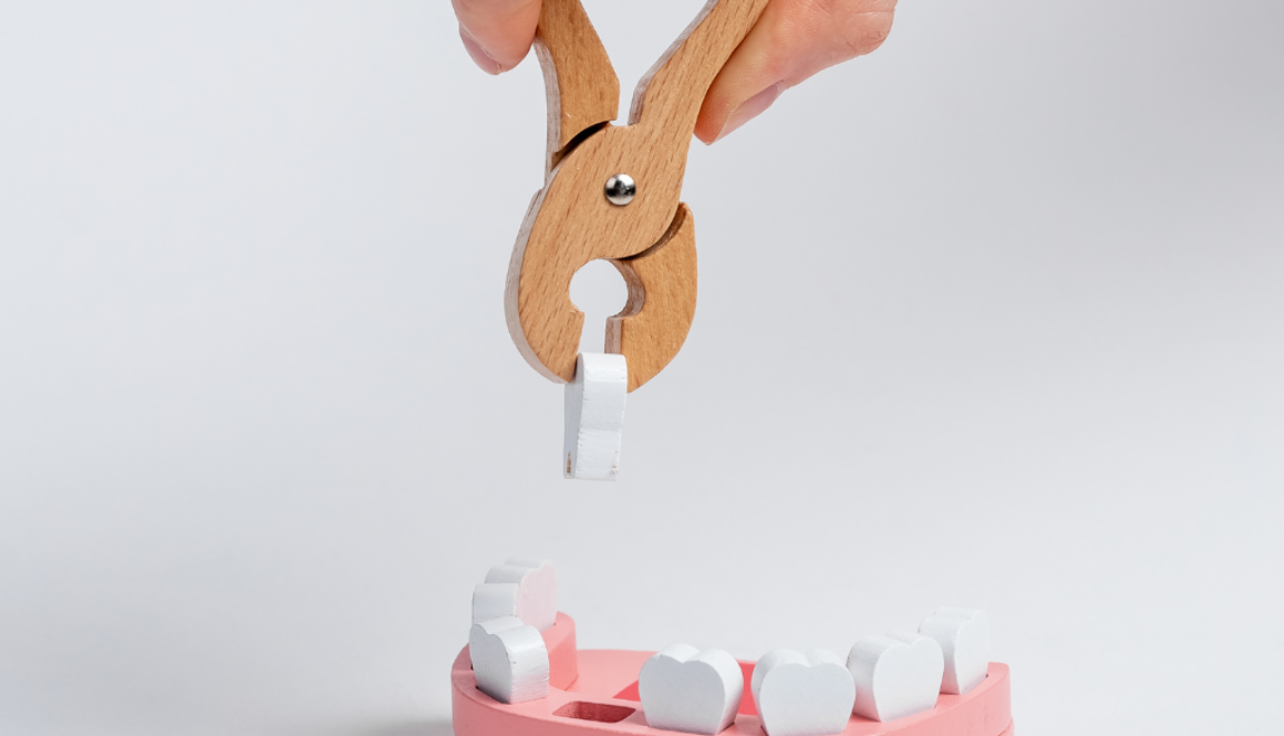 Beyond the Pull Simple, Surgical, and Wisdom Tooth Extractions in Richmond Hill